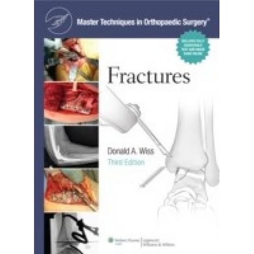 Master Techniques in Orthopaedic Surgery: Fractures (English) 3 Rev ed Edition
